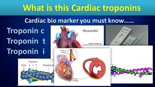 What is this Cardiac troponinsCardiac bio markers in Myocardial ischemia [upl. by Beare]