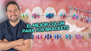 EL MEJOR y PEOR COLOR DE LIGAS PARA TÚ TRATAMIENTO DE BRACKETS  COMBINACIONES DE COLORES ORTODONCIA [upl. by Shanan]