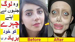 People Who Destroyed their Faces with Cosmetic Surgeries [upl. by Gorges207]