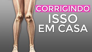 Como corrigir o Joelho VALGO  Joelho para DENTRO Em CASA 3 Exercícios [upl. by Gilpin690]