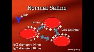 Pretransfusion Testing [upl. by Gaylor416]