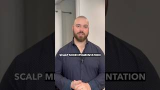 🛑How long does Scalp Micropigmentation actually last🛑 SMP in Sarnia smp bald hair sarnia [upl. by Nytsirhc]