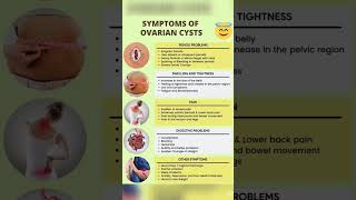 ovarian cyst signs and symptoms [upl. by Hanej680]