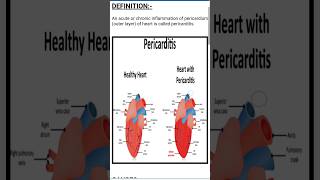 PERICARDITIS  medicalsurgicalnursing cardiac subscribe support youtubeshorts trending surat [upl. by Oruhtra]