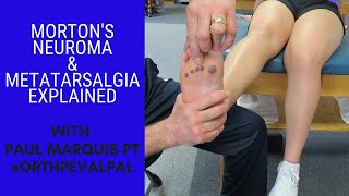 Mortons Neuroma and Metatarsalgia Whats the Difference [upl. by Vladimar383]