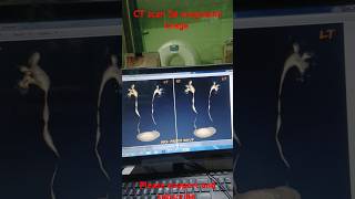 CT scan 3d urography final image reportshortvideo anatomy [upl. by Leoine]