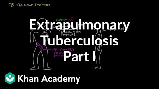 Extrapulmonary TB part 1  Infectious diseases  NCLEXRN  Khan Academy [upl. by Glynnis327]