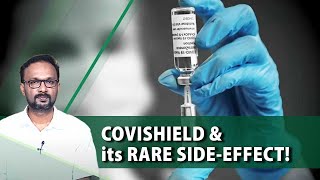 What is the rare sideeffect of AstraZeneca Covid vaccine [upl. by Reamy900]