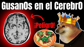 EL PELIGR0 DE COMER TAQUITOS EN LA CALLE  La neurocisticercosis [upl. by Odiug207]