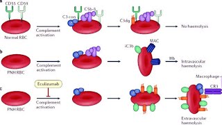 Paroxysmal nocturnal hemoglobinuria PNH [upl. by Adnahsam808]