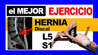 ✅el MEJOR Ejercicio para la HERNIA Discal L5 S1 [upl. by Chloras]