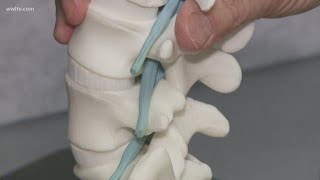 What is Lumbar Spine Stenosis A Complete Guide to Treatments [upl. by Wendi]