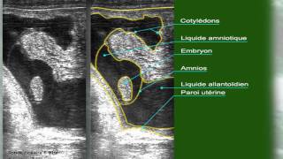 ECHO Dracht RUND THEORETISCHE VOORBESCHOUWING [upl. by Anitnamaid962]