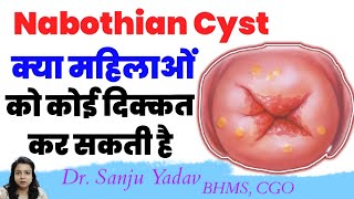 Nabothian cyst क्या महिलाओं को दिक्कत करती हैं [upl. by Odrick214]