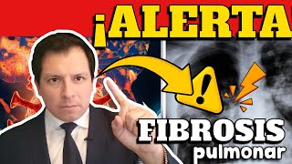 ALERTA ⚠️ CIENTÍFICOS REVELAN QUE INCIDENCIA DE FIBROSIS PULMONAR INCREMENTARÍA POR COVID19 [upl. by Lamb]