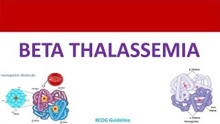 Management of Beta Thalassemia in Pregnancy RCOG Guideline [upl. by Atineg269]