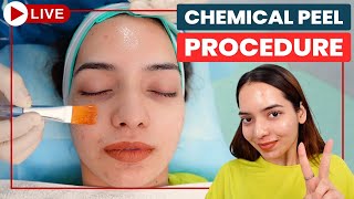 CHEMICAL PEELS Step by Step  Acne Scar Treatment in Delhi  Chemical Peeling Treatment Dr Jangid [upl. by Sherrill]