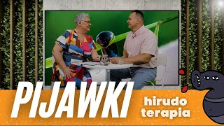 PIJAWKI w czym nam może pomóc hirudoterapia [upl. by Baerl]