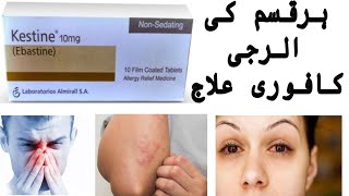 how to use Kestine tablet 10 mg uses Benefits Side Effects complete review in urdu hindi [upl. by Wendel]