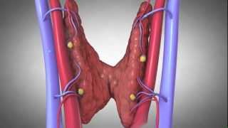 Parathyroides et Lhyperparathyroïdisme [upl. by Rozella]