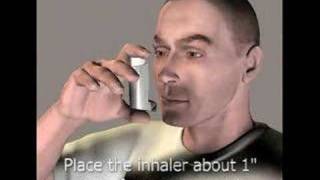 3D Medical Animation Inhaler [upl. by Kenleigh549]