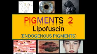 Pigments  2 Lipofuscin  Endogenous pigments [upl. by Nnylkcaj]