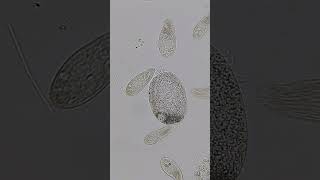 Paramecium and Ciliates 100x  800x Magnification science microscope 11 [upl. by Ahter136]