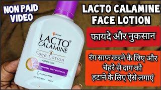 Lacto Calamine Face Lotion लैक्टो कैलामाइन लोशन  How to use lacto calamine lotion Review In Hindi [upl. by Greenlee]