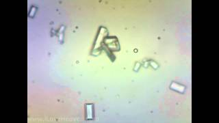 Feline Urine Sample with Struvite Crystals 4 Microscope Camera [upl. by Yebba]