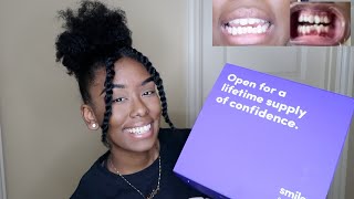 Smile direct club  Final Review  MY TEETH ARE DIFFRENT  BRACES [upl. by Taffy]