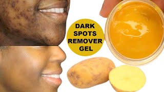 YOUR DARK SPOTS WILL BE GONE OVERNIGHT APPLY AT NIGHT TO DARK SPOTS WAKE UP WITH CLEAR SKIN [upl. by Ozner]