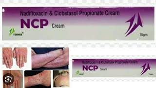 NCP Cream Madifloxacin amp Clobetasol Propionate Cream [upl. by Ateekan]