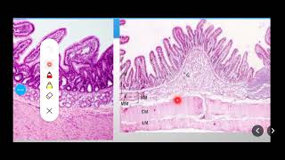 Histology Slides Series Episode 10  Histology of the Small Intestine Duodenum Jejunum Ileum [upl. by Orvie]