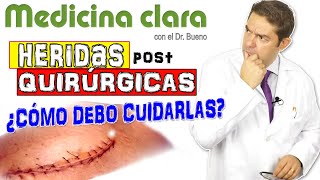 CUIDADO de CICATRICES y HERIDAS postquirúrgicas EN CASA Evitar MARCAS de HERIDAS  Medicina Clara [upl. by Francesca181]