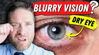 Why Dry Eyes Cause Blurry Vision  3 Reasons And 3 Home Remedies [upl. by Aggappora303]