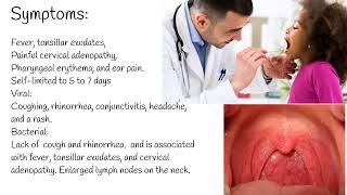 Pharyngitis  Symptoms causes and Treatment Streptococcal pharyngitis [upl. by Lacim191]