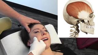 Temporal Headaches  Temporalis Muscle Internal Release Procedure  MSR Demo [upl. by Fretwell]