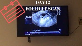 DAY 12 FOLLICLE SCAN [upl. by Quenna]