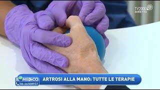 Artrosi alla mano ecco i sintomi La visita e tutte le terapie [upl. by Anoyek177]