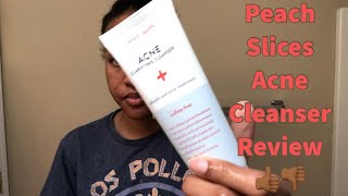 Trying Peach Slices Acne Clarifying Cleanser on my Fungal Acne Prone Skin  Full Week Review [upl. by Nehgem312]