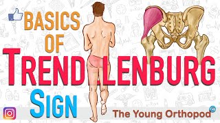 Trendelenburgs Sign  ANIMATION  BASICS  The Young Orthopod  Trendelenberg Sign [upl. by Nairde]