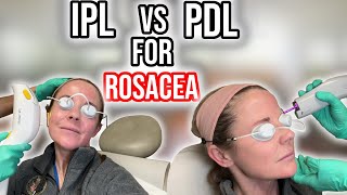 PDL vs IPL for Rosacea Dermatologist guide [upl. by Eiramoj]