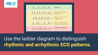 Distinguishing between regular and irregular abnormalities [upl. by Duffy320]