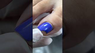 Нарастить или спилить сломанный уголок ногтя  nails педикюр pedicure [upl. by Nial]