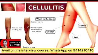 Cellulitis  Ssc amc interview questions  Army medical corps interview  Interview Guide [upl. by Kippie161]