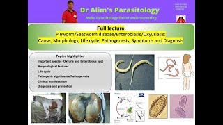 Pinwormseatworm Cause morphology life cycle pathogenesis symptoms and diagnosis  English I [upl. by Jurgen]