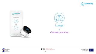 Lungs auscultation  coarse crackles 1 [upl. by Ainafets]