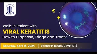 Walkin Patient with VIRAL KERATITIS [upl. by Nebuer]