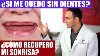 SI ME QUEDO SIN DIENTES ¿QUÉ OPCIONES TENGO PARA SONREIR Y MASTICAR DE NUEVO  Dentadura implantes [upl. by Ahtnammas]