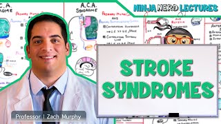 Stroke Syndromes MCA ACA ICA PCA Vertebrobasilar Artery Strokes  Pathophysiology [upl. by Einahpet]